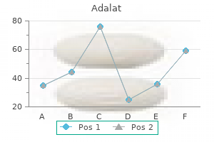 adalat 30 mg generic with amex