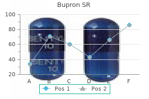 150 mg bupron sr discount amex