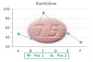 generic ranitidine 300 mg