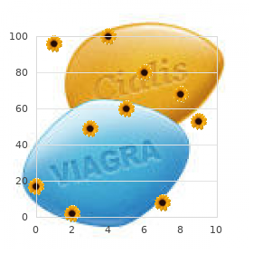 Chromosome 5, monosomy 5q35